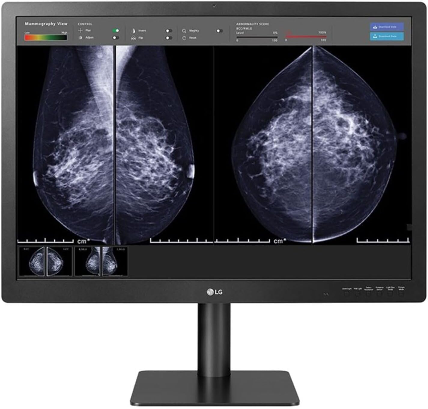 Màn hình LG 31IN Medical chống chói, 3H DIGNOSTIC 4200 X 2800 (3:2) Loại II FDA